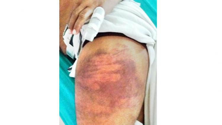 ಹೆಲ್ಮೆಟ್ ಧರಿಸದ್ದಕ್ಕೆ ಹೊಡೆಯಬೇಕೇ?