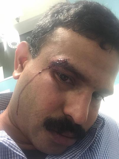 ಆಸ್ಟ್ರೇಲಿಯಾ: ಮತ್ತೊಬ್ಬ ಭಾರತೀಯನ ಮೇಲೆ ಜನಾಂಗೀಯ ನಿಂದನೆ, ಗಂಭೀರ ಹಲ್ಲೆ