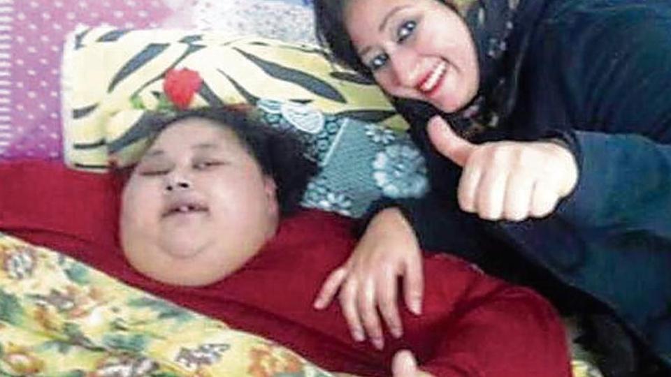 ವಿಶ್ವದ ಅತ್ಯಂತ ತೂಕದ ಮಹಿಳೆಗೆ ಯಶಸ್ವಿ ಶಸ್ತ್ರಚಿಕಿತ್ಸೆ