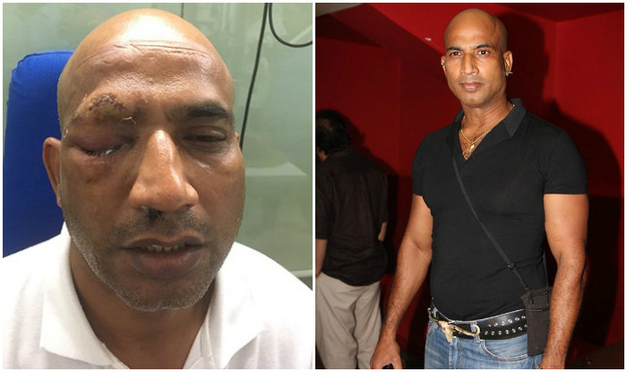 ಬಾಲಿವುಡ್ ನಟನ ಮೇಲೆ ಹಲ್ಲೆ, ಕಣ್ಣಿಗೆ ಗಂಭೀರ ಗಾಯ