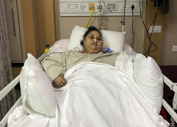 ಈಜಿಪ್ಟ್‌ನ ಮಹಿಳೆ ಇಮಾನ್ ಅಹ್ಮದ್‌ ತೂಕ  ಅರ್ಧದಷ್ಟು   ಇಳಿಕೆ