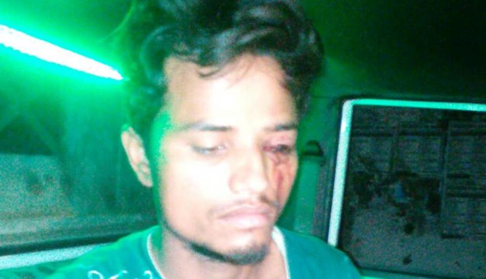 ದನವನ್ನು ಓಡಿಸಲು ಹಾರ್ನ್ ಬಾರಿಸಿ ಕಣ್ಣು ಕಳೆದುಕೊಂಡ ವ್ಯಾನ್ ಚಾಲಕ