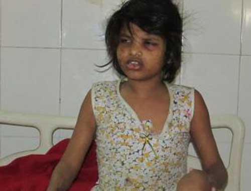 ಅರಣ್ಯದಲ್ಲಿ ಮಂಗಗಳೊಂದಿಗೆ ವಾಸವಾಗಿದ್ದ ಬಾಲಕಿ ಪತ್ತೆ