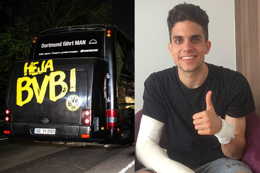 ಬಾಂಬುಸ್ಫೋಟದಲ್ಲಿ ಗಾಯಗೊಂಡಿದ್ದ ಫುಟ್ಬಾಲ್ ಆಟಗಾರ ಸಂಪೂರ್ಣ ಚೇತರಿಕೆ, ತಂಡದ ತರಬೇತಿಯಲ್ಲಿ ಭಾಗಿ