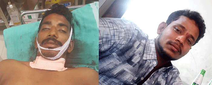 ಚೂರಿಯಿಂದ ಇರಿದು ಸಹೋದರನನ್ನೇ ಕೊಂದ ಯುವಕ