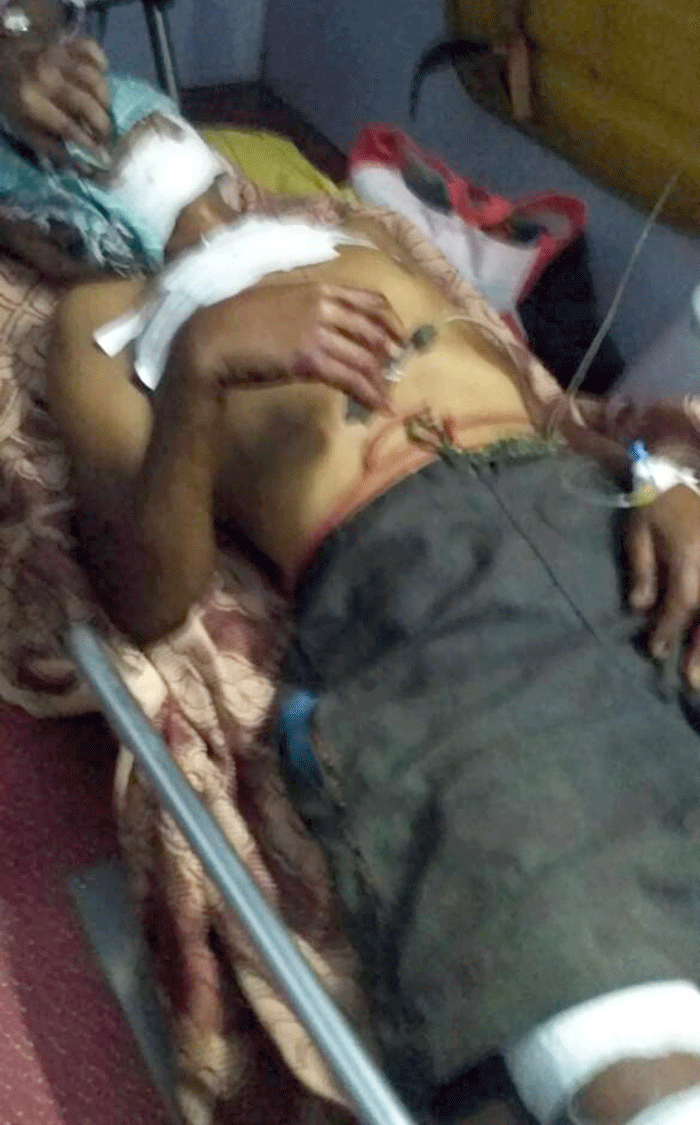 ವೃದ್ಧನ ಮೇಲೆರಗಿದ ಕರಡಿಗಳು