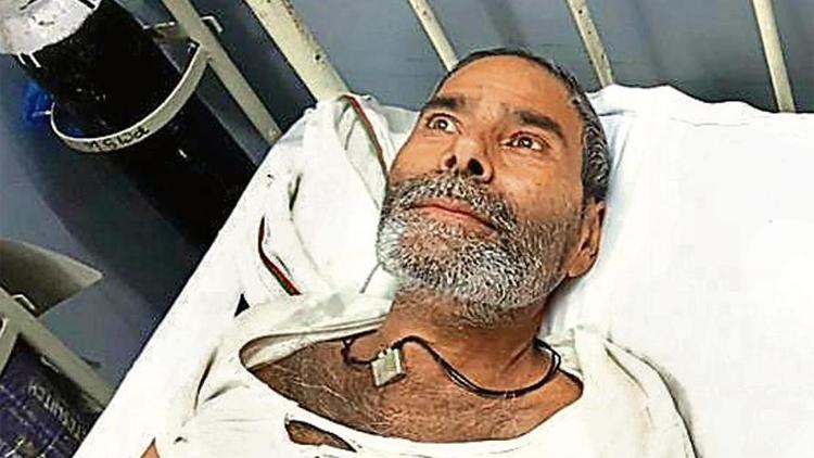 ಈ ವ್ಯಕ್ತಿಯ ಶರೀರದಲ್ಲಿ 75 ಪಿನ್‌ಗಳು !