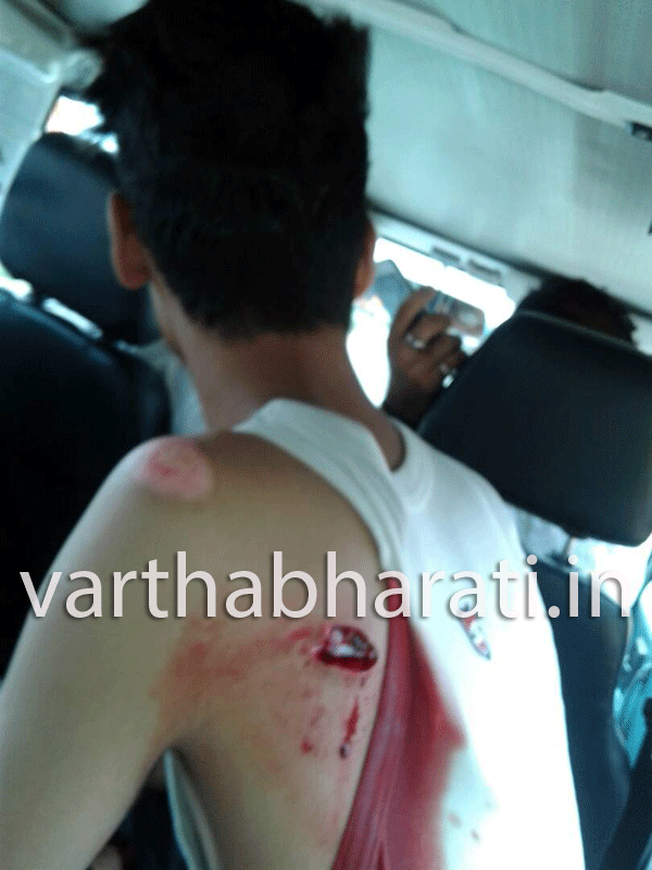 ಕಲ್ಲಡ್ಕ: ಮಸೀದಿಯಿಂದ ಮನೆಗೆ ತೆರಳುತ್ತಿದ್ದ ಯುವಕನಿಗೆ ಚೂರಿ ಇರಿತ