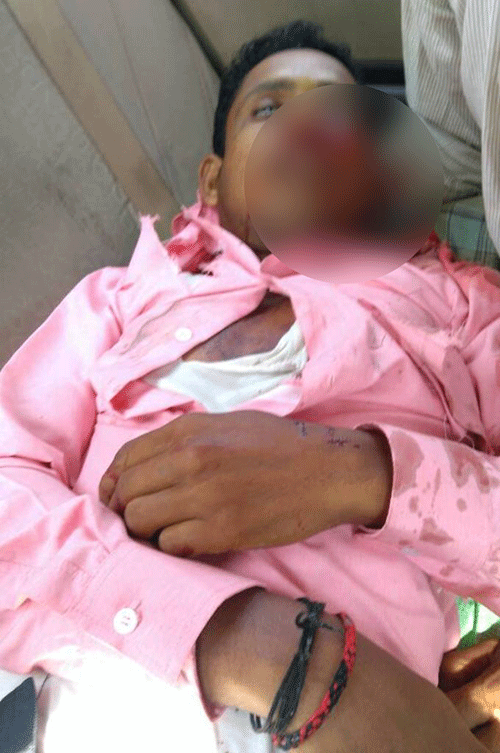 ಬೈಕ್‌-ಮಿನಿ ಲಾರಿ ಢಿಕ್ಕಿ: ಬೈಕ್ ಸವಾರ ಮೃತ್ಯು