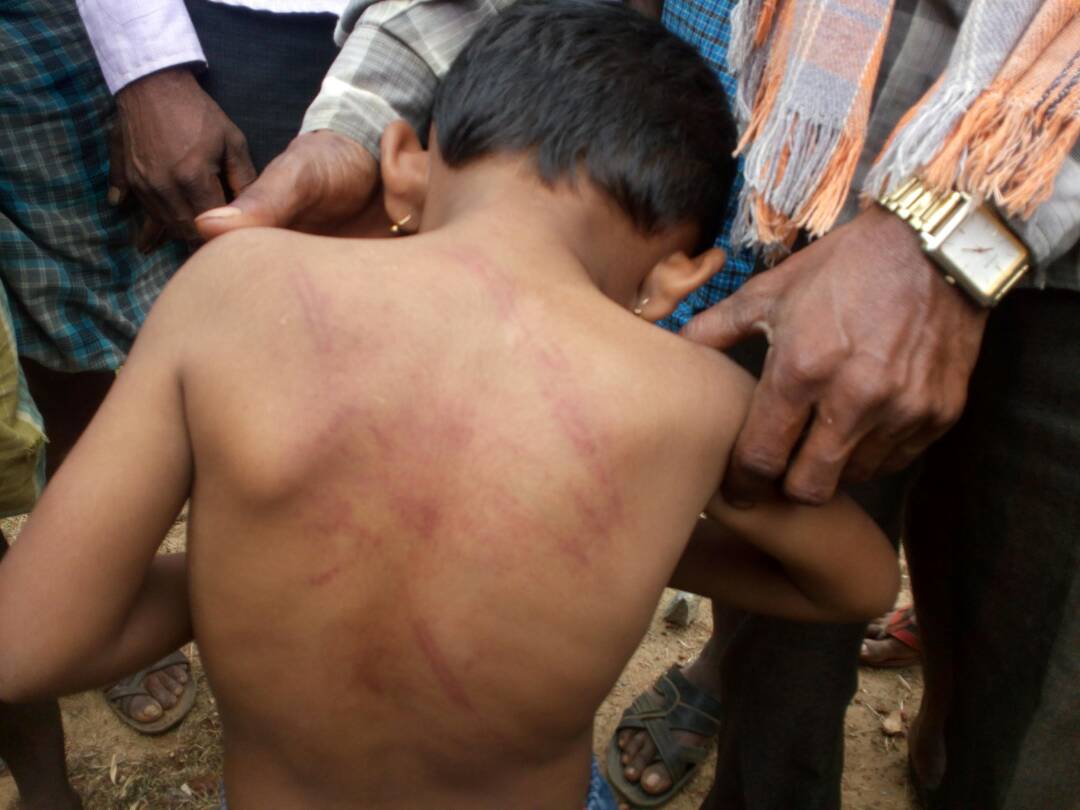 ಅಂಗನವಾಡಿ ಕಾರ್ಯಕರ್ತೆಯಿಂದ ಮಗುವಿಗೆ ಥಳಿತ