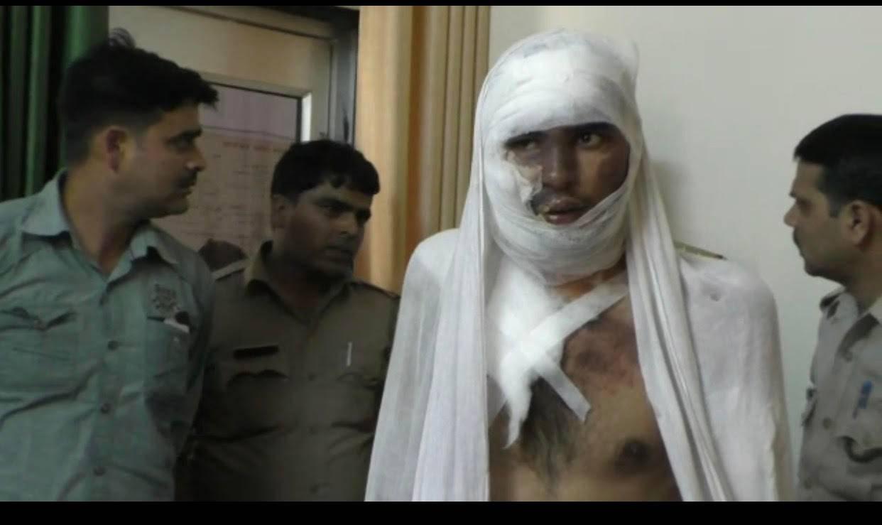 ಗಡ್ಡ ಬೋಳಿಸಲು ನಿರಾಕರಿಸಿದ ಪತಿಯ ಮೇಲೆ ಬಿಸಿನೀರು ಎರಚಿದ ಪತ್ನಿ!