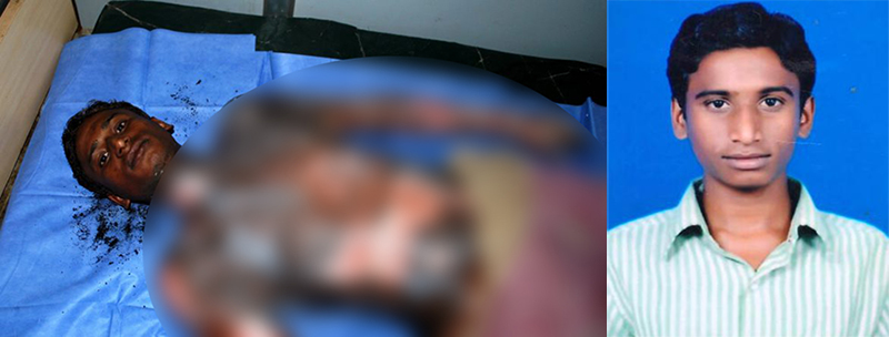 ದುಷ್ಕರ್ಮಿಗಳು ಬೆಂಕಿ ಹಚ್ಚಿದ್ದ ಪ್ರಕರಣ: ಚಿಕಿತ್ಸೆ ಫಲಕಾರಿಯಾಗದೆ ಯುವಕ ಮೃತ್ಯು