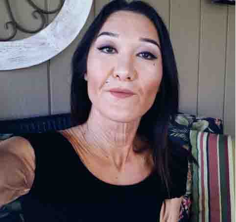 ಜೋಲು ಬಿದ್ದಿರುವ ಚರ್ಮದ ಈ ಮಾಡೆಲ್ ವಯಸ್ಸು 26 ವರ್ಷಗಳೆಂದರೆ ನಂಬುತ್ತೀರಾ.....?