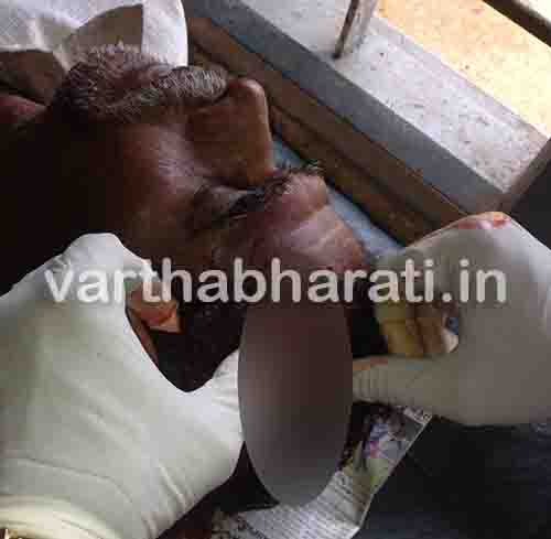 ತಂದೆಗೆ ಮಾರಣಾಂತಿಕವಾಗಿ ಹಲ್ಲೆಗೈದ ಮಗ