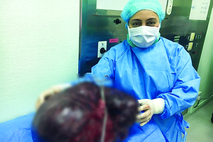 ಈ ಮಹಿಳೆಯ ಹೊಟ್ಟೆಯಲ್ಲಿದ್ದ ಗೆಡ್ಡೆಯ ತೂಕ ತಿಳಿದರೆ ಒಂದು ಕ್ಷಣ ಬೆಚ್ಚಿಬೀಳುತ್ತೀರಿ…