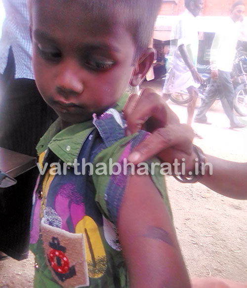 ಅಂಗನವಾಡಿ ಮಕ್ಕಳಿಗೆ ಬರೆ ಎಳೆದ ಶಿಕ್ಷಕಿ