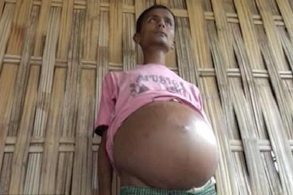 ಸಾವನ್ನೇ ನಿರೀಕ್ಷಿಸುತ್ತಿರುವ ಈ ಹುಡುಗ ಹಗಲಲ್ಲಿ ಕೇವಲ ಒಂದು ಗಂಟೆ ಮಾತ್ರ ನಿದ್ರಿಸಬಲ್ಲ!