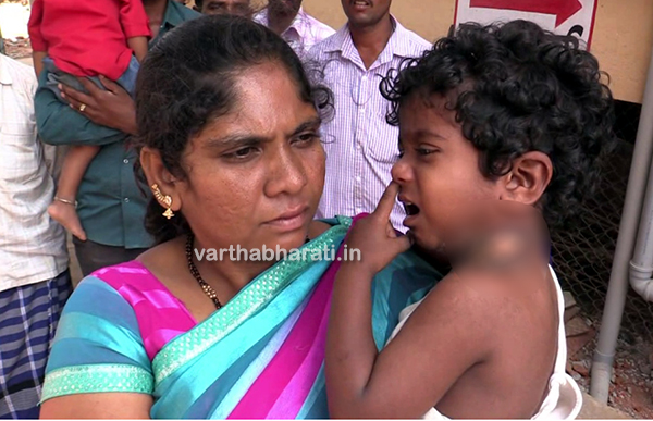 ಅಂಗನವಾಡಿ ಸಹಾಯಕಿಯಿಂದ ದಲಿತ ಬಾಲಕನಿಗೆ ಬಿಸಿ ಸೌಟಿನಿಂದ ತಿವಿದು ಹಿಂಸೆ