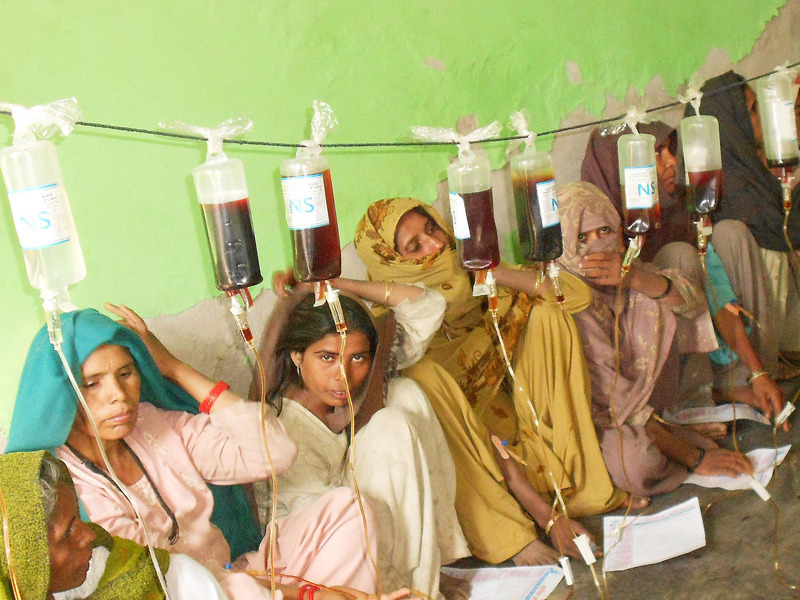 ಭಾರತೀಯ ಮಹಿಳೆಯರನ್ನು ಕಾಡುತ್ತಿದೆ ರಕ್ತಹೀನತೆ...