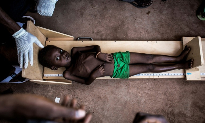 ಡಿಆರ್‌ಕಾಂಗೊ: 4 ಲಕ್ಷ ಮಕ್ಕಳು ಸಾವಿನ ಅಂಚಿನಲ್ಲಿ