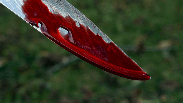 ಮೊದಲ ರಾತ್ರಿ ಪತಿಯ ರಾಕ್ಷಸಿ ಪ್ರವೃತ್ತಿ: ಮಹಿಳೆ ಗಂಭೀರ