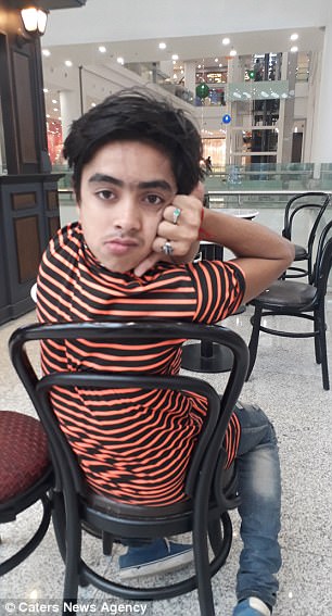 ತಲೆಯನ್ನು 180 ಡಿಗ್ರಿ ಹಿಂದೆ ತಿರುಗಿಸಬಲ್ಲ ಬಾಲಕ ತಲೆಯನ್ನು 180 ಡಿಗ್ರಿ ಹಿಂದೆ ತಿರುಗಿಸಬಲ್ಲ ಬಾಲಕ