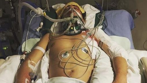 17 ಮೂಳೆ ಮುರಿತಕ್ಕೊಳಗಾಗಿ ಜೀವನ್ಮರಣ ಹೋರಾಟ ನಡೆಸಿದ್ದ ಅಥ್ಲೀಟ್‌ಗೆ ಒಲಿಂಪಿಕ್ಸ್ ಪದಕ!