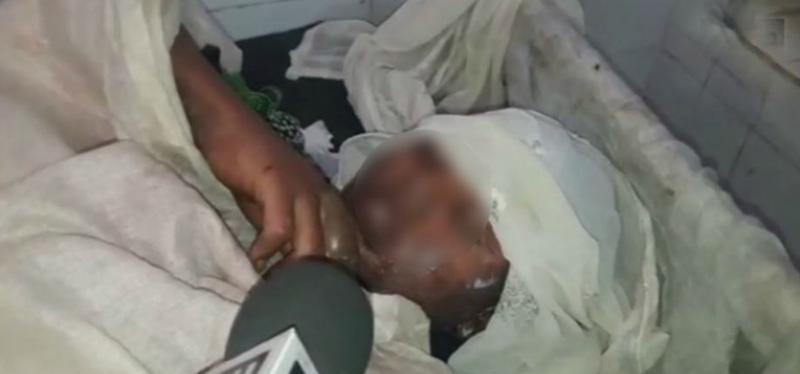 ಲೈಂಗಿಕ ಕಿರುಕುಳ ವಿರೋಧಿಸಿದ್ದಕ್ಕೆ ಬಾಲಕಿಗೆ ಬೆಂಕಿ ಹಚ್ಚಿದ ಬಾಲಕ