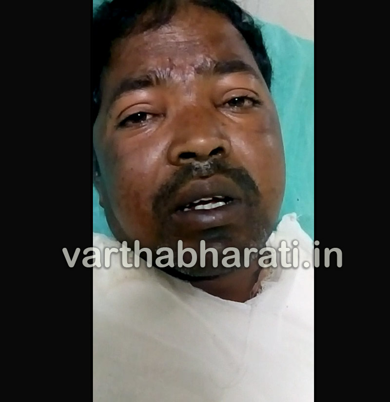 ಹಾಸನ: ಬೆಂಕಿ ದಾಳಿಗೆ ಒಳಗಾಗಿದ್ದ ವ್ಯಕ್ತಿ ಮೃತ್ಯು