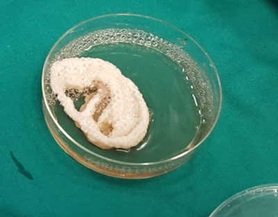 ಪ್ರಯೋಗಾಲಯದಲ್ಲಿ ಕಿವಿಯನ್ನು ಬೆಳೆಸಿದ ಭಾರತದ ವೈದ್ಯರು, ವಿಜ್ಞಾನಿಗಳು!