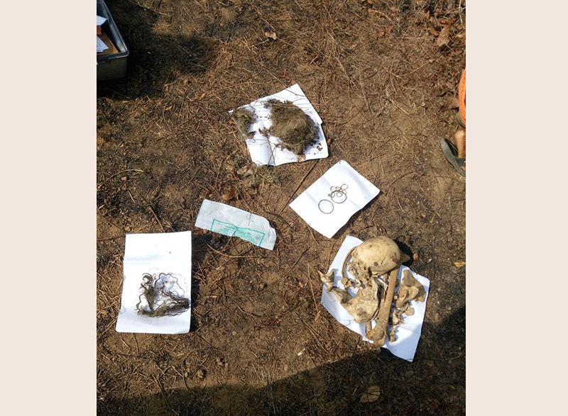 ಅಮ್ಮುಂಜೆಯಲ್ಲಿ ಮಹಿಳೆಯ ಅಸ್ಥಿಪಂಜರ ಪತ್ತೆ