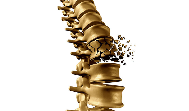 ಪುರುಷರಲ್ಲಿ ಅಸ್ಥಿರಂಧ್ರತೆಯ ಅಪಾಯ ಹೆಚ್ಚಲು ಕಾರಣಗಳು ಗೊತ್ತೇ....?