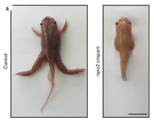 ಮಾನವನ ಕೈ-ಕಾಲು ನ್ಯೂನತೆಗೆ ಕಾರಣವಾದ ಹೊಸ ಜೀನ್ ಪತ್ತೆ