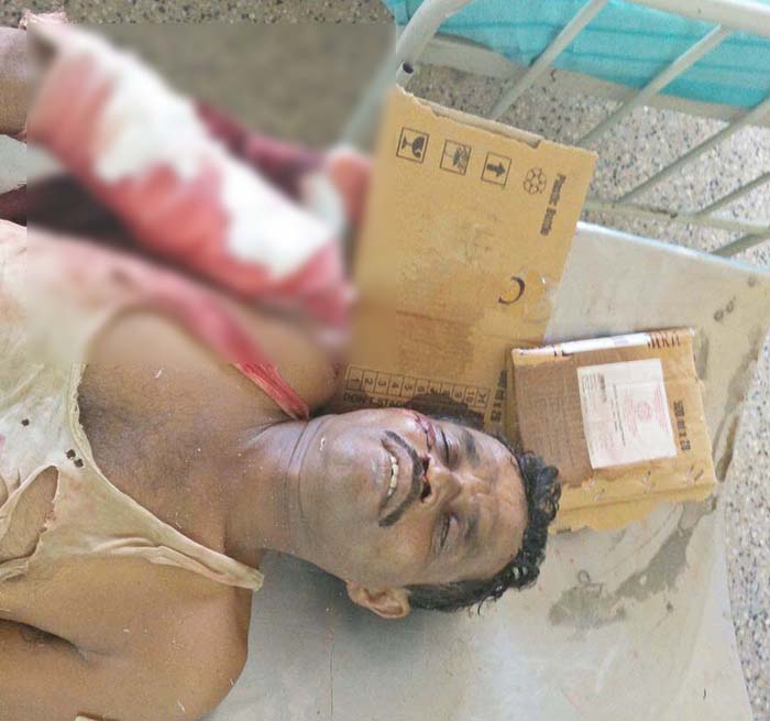 ನಾಗಮಂಗಲ: ಟಿಪ್ಪರ್ ಢಿಕ್ಕಿಯಾಗಿ ಅಪರಿಚಿತ ಬೈಕ್ ಸವಾರ ಮೃತ್ಯು