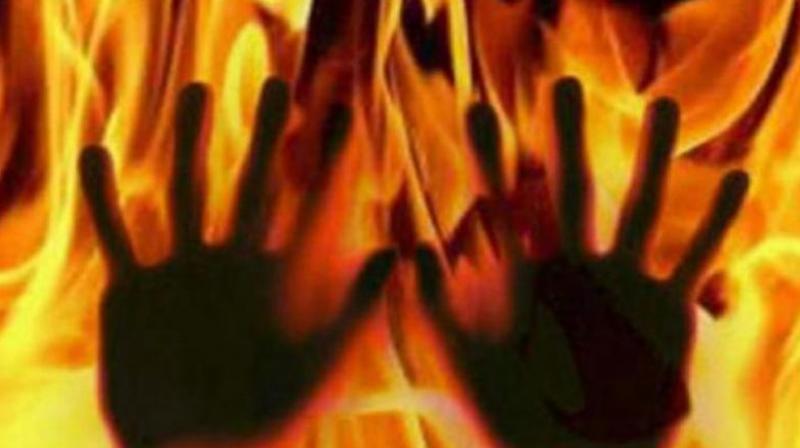 ಉ.ಪ್ರದೇಶ: ಮೊಬೈಲ್ ನಂಬರ್ ಕೊಡಲು ನಿರಾಕರಿಸಿದ ದಲಿತ ಬಾಲಕಿಗೆ ಬೆಂಕಿ ಹಚ್ಚಿದ ದುಷ್ಕರ್ಮಿ