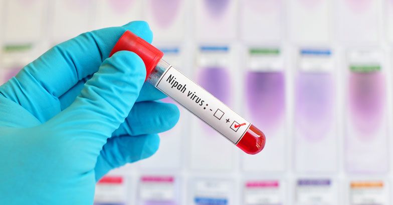 ನಿಪಾಹ್ ವೈರಸ್ ಲಕ್ಷಣಗಳಿರುವ ಕನಿಷ್ಠ 753 ಜನರ ಮೇಲೆ ನಿಗಾ: ಡಬ್ಲ್ಯುಎಚ್‌ಒ