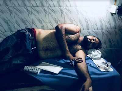 ಕಫೀಲ್ ಖಾನ್ ಸಹೋದರನ ಮೇಲೆ ಗುಂಡಿನ ದಾಳಿ : ಅಪರಿಚಿತ ದುಷ್ಕರ್ಮಿಗಳ ವಿರುದ್ಧ ಪ್ರಕರಣ ದಾಖಲು