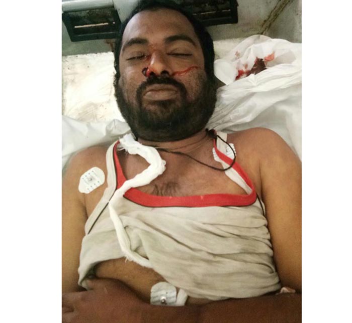 ಮಂಡ್ಯ: ಹೆಜ್ಜೇನು ದಾಳಿಗೆ ವ್ಯಕ್ತಿ ಬಲಿ