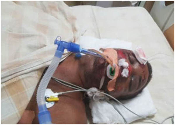 ಉಡುಪಿ: ಗಾಯಾಳುವಿನ ಗುರುತು ಪತ್ತೆಗೆ ಮನವಿ