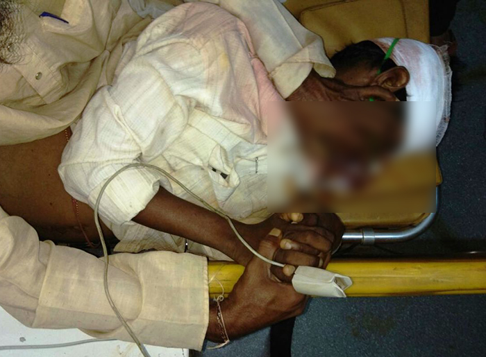 ಮುಂಡಗೋಡ: ಬೈಕ್ ಢಿಕ್ಕಿಯಾಗಿ ಪಾದಚಾರಿ ಗಂಭೀರ