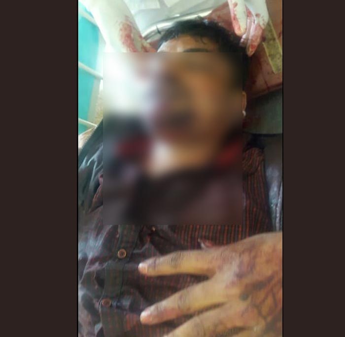 ನಾಗಮಂಗಲ: ಯುವಕನಿಗೆ ಮಾರಣಾಂತಿಕ ಹಲ್ಲೆ ನಡೆಸಿ ಬೈಕ್, ಹಣ ದೋಚಿ ಪರಾರಿ