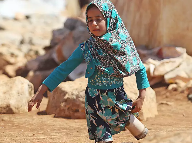 ಕ್ಯಾನ್‌ಗಳನ್ನು ಧರಿಸಿ ನಡೆದಾಡುವ ಎರಡೂ ಕಾಲುಗಳಿಲ್ಲದ ಬಾಲಕಿ