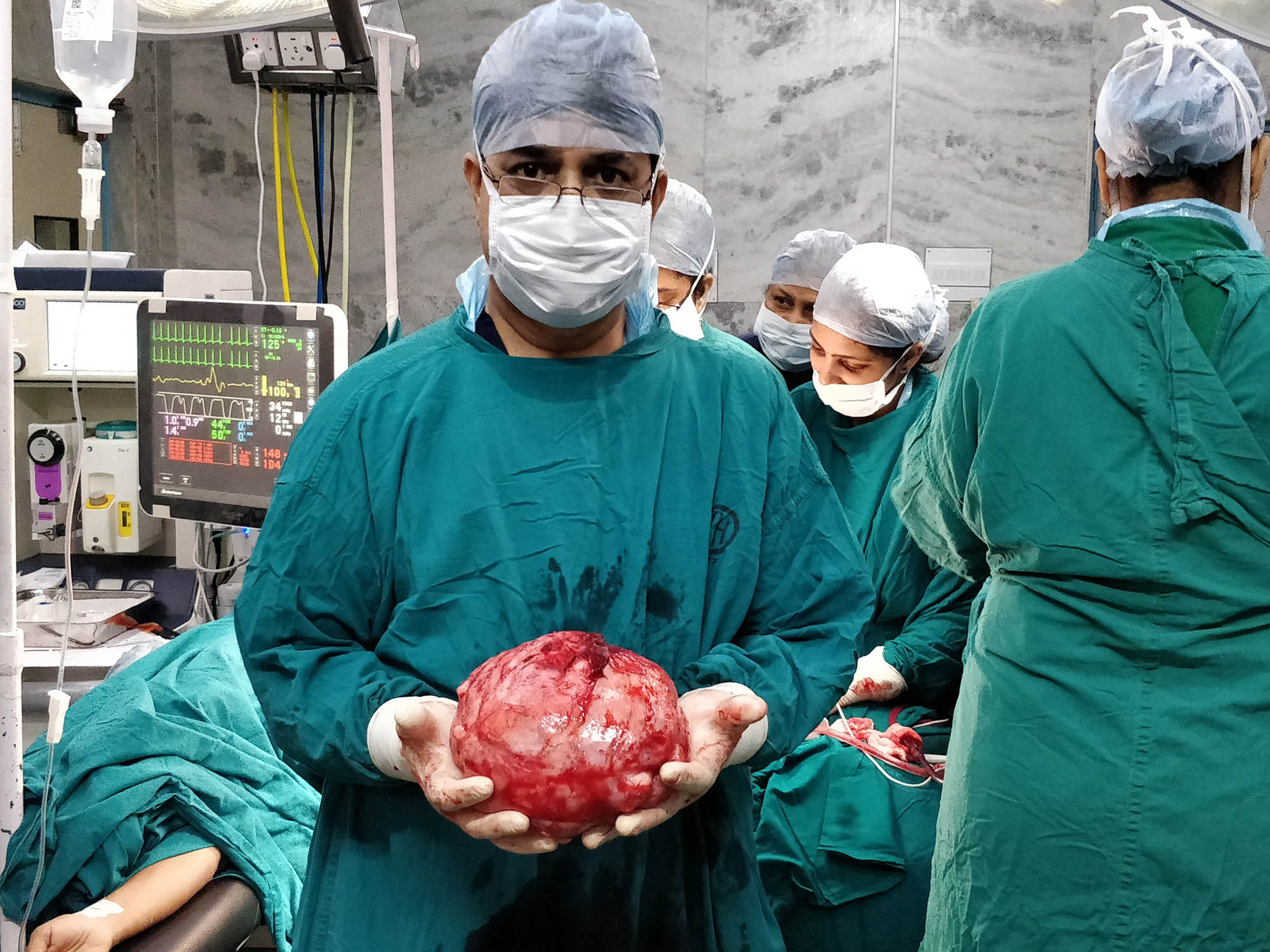 ಮಣಿಪಾಲ: ಮಹಿಳೆಯ ಹೊಟ್ಟೆಯಲ್ಲಿ ದೊಡ್ಡ ಫೈಬ್ರಾಯ್ಡಾ ಗಡ್ಡೆ