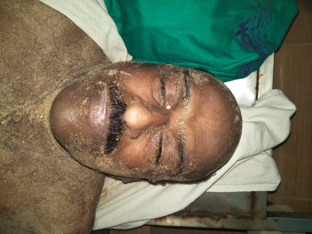 ಮಲ್ಪೆ ಸಮುದ್ರದಲ್ಲಿ ಮುಳುಗಿ ಅಪರಿಚಿತ ವ್ಯಕ್ತಿ ಮೃತ್ಯು ಮಲ್ಪೆ ಸಮುದ್ರದಲ್ಲಿ ಮುಳುಗಿ ಅಪರಿಚಿತ ವ್ಯಕ್ತಿ ಮೃತ್ಯು