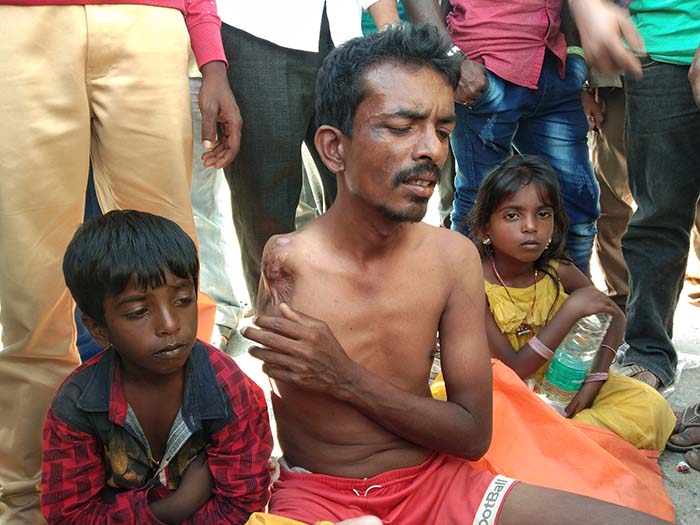 ರೈಲ್ವೆ ಇಲಾಖೆಯಿಂದ ಅನ್ಯಾಯ ಆರೋಪ: ವಿಕಲಾಂಗನಿಂದ ನಡುಬೀದಿಯಲ್ಲಿ ಪ್ರತಿಭಟನೆ