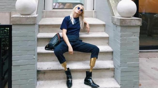 ದಣಿದು ನಿದ್ದೆ ಹೋದವಳು ಎಚ್ಚರಗೊಂಡ ಮೇಲೆ ಎರಡೂ ಕಾಲುಗಳನ್ನು ಕಳೆದುಕೊಂಡಳು