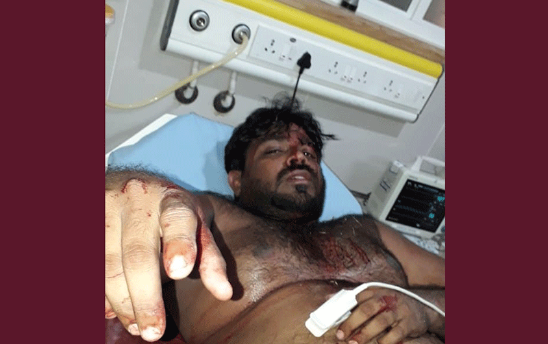 ಮಂಗಳೂರು ವಿಮಾನ ನಿಲ್ದಾಣದಲ್ಲಿ ಓಲಾ ಚಾಲಕನ ಮೇಲೆ ಹಲ್ಲೆ: ದೂರು