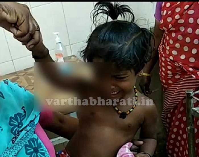 ಮನೆ ಮುಂದೆ ಆಟವಾಡುತ್ತಿದ್ದ ಮಗುವಿನ ಮೇಲೆ ಬೀದಿ ನಾಯಿ ದಾಳಿ