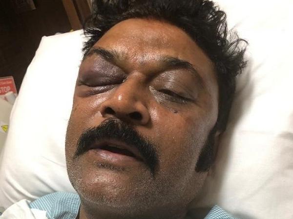 ಆನಂದ್ ಸಿಂಗ್ ಆರೋಗ್ಯ ವಿಚಾರಿಸಿದ ಮುಖ್ಯಮಂತ್ರಿ ಕುಮಾರಸ್ವಾಮಿ