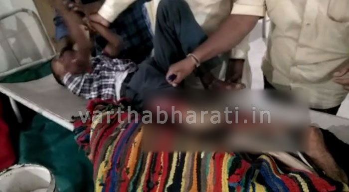 ಲಾರಿ ಹರಿದು ವಿದ್ಯಾರ್ಥಿಗೆ ಗಂಭಿರ ಗಾಯ